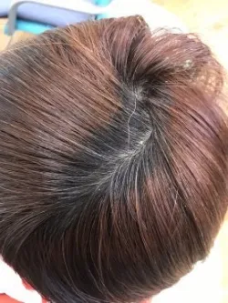 before：赤みの多い色